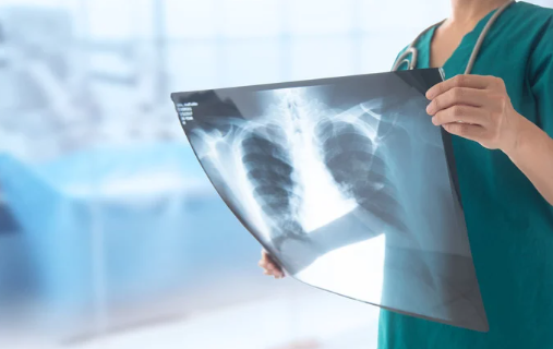 how many x rays can you have in a year