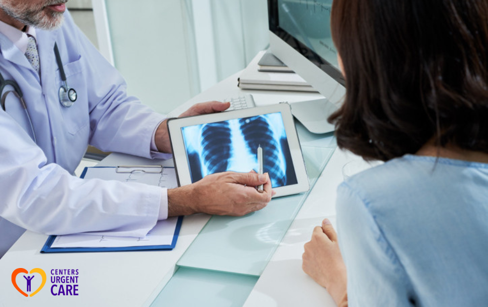 pneumonia x ray female