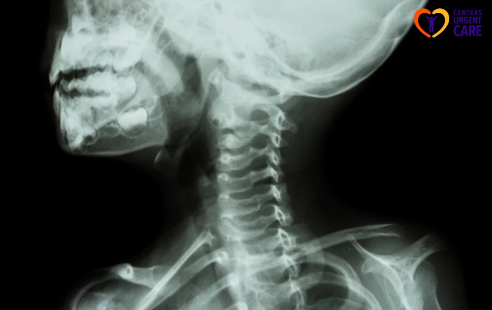 c spine x ray