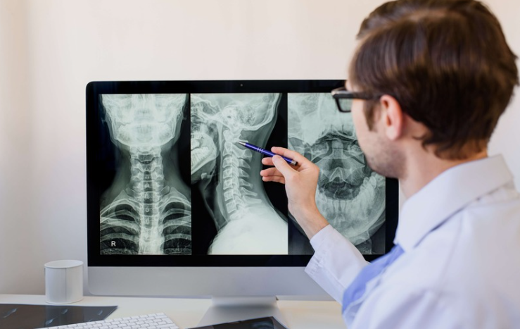 https://centersurgentcare.net/wp-content/uploads/2024/10/c-spine-x-ray.png?utm_source=chatgpt.com