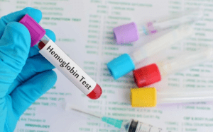 hemoglobin blood test