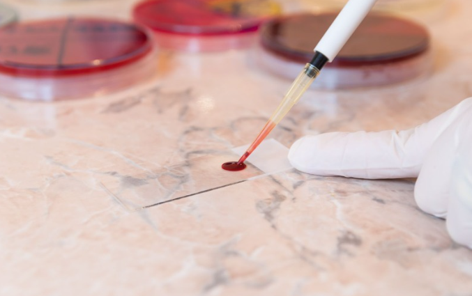 how to perform a blood smear