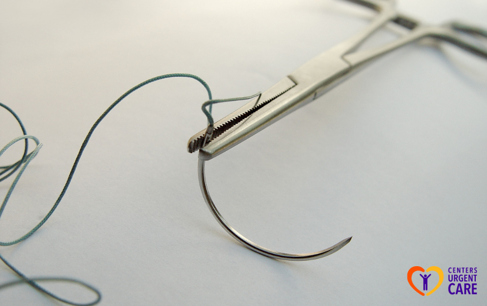 does urgent care do stitches