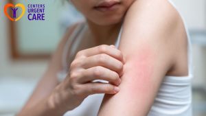 Common Skin Infections