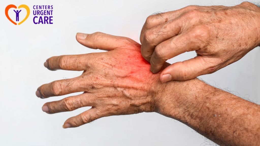 Common Skin Infections