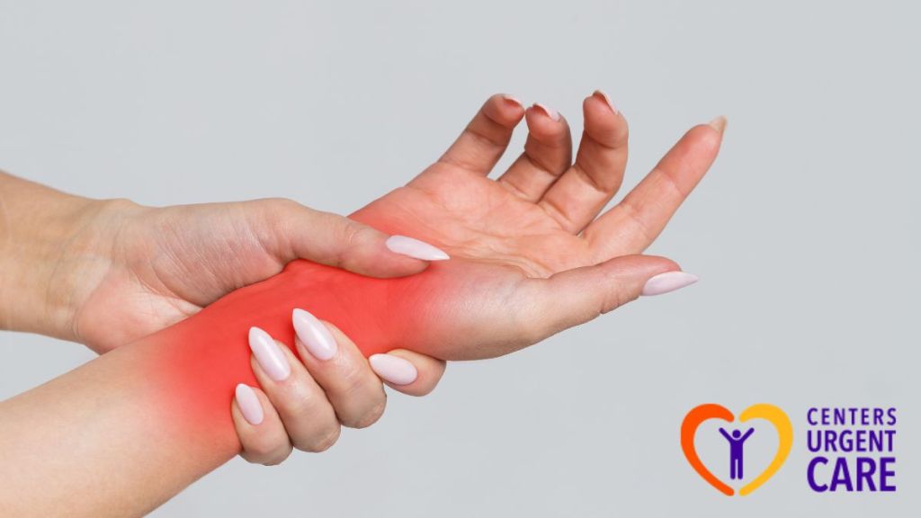 Wrist Sprain Management