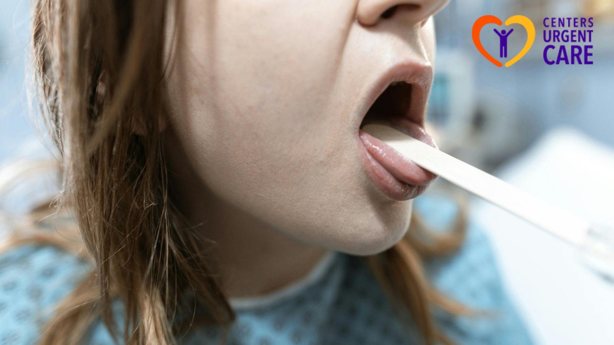 Strep Throat Management