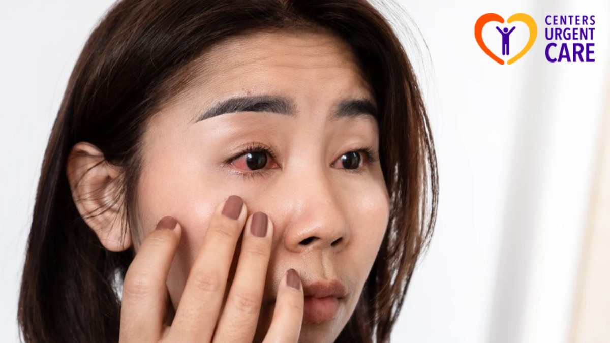 Pink Eye Diagnosis