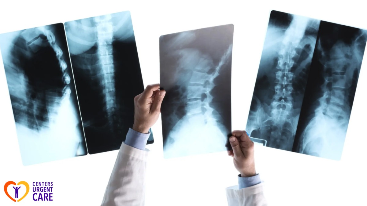 can X-rays detect soft tissue damage