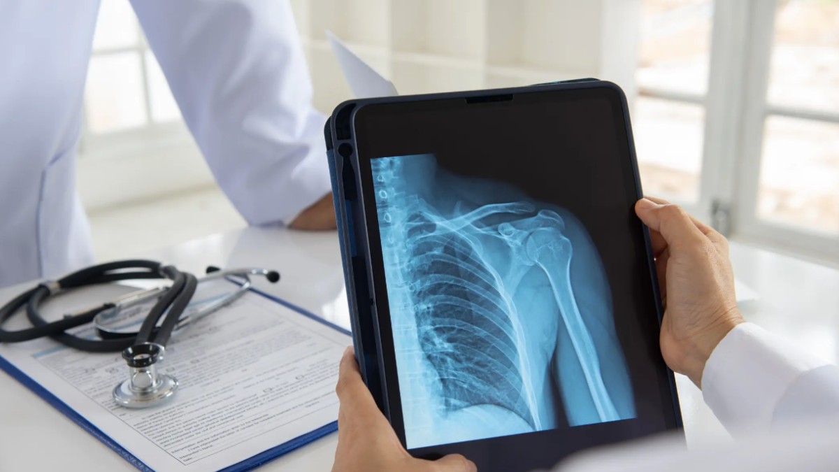 Wondering How Long X-Ray Results Take? Find Out Here - Centers Urgent Care