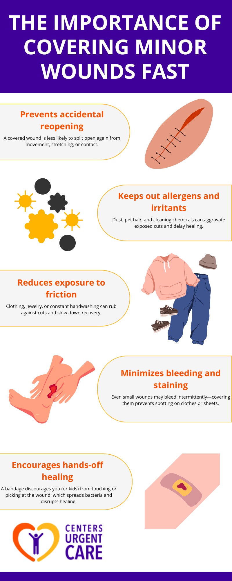 should you cover small cuts