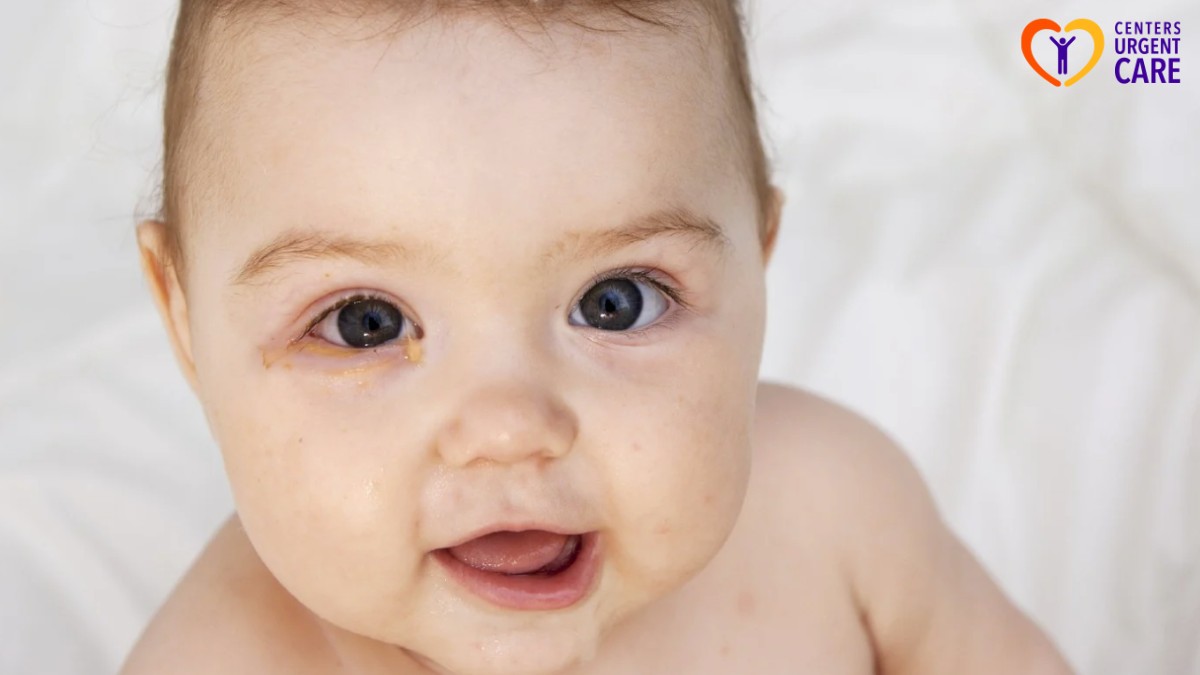 how to treat pink eye in toddlers