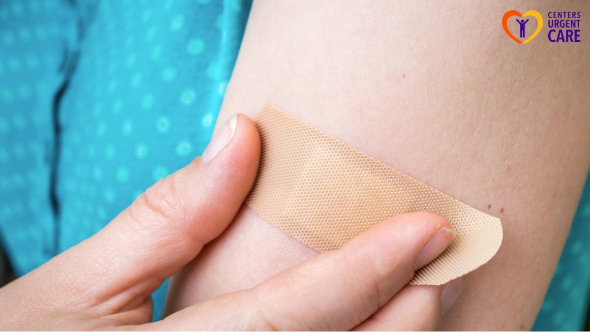 should you cover small cuts 1