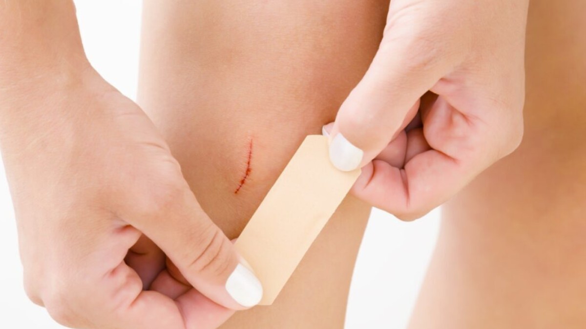 should you cover small cuts