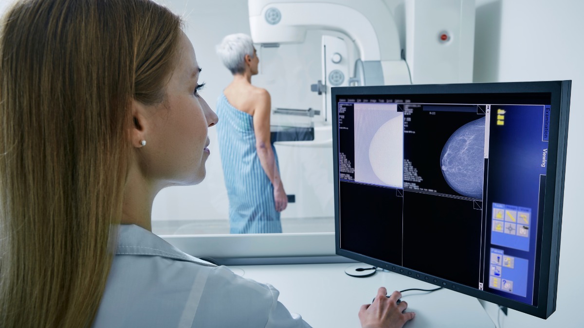 x-ray in mammography