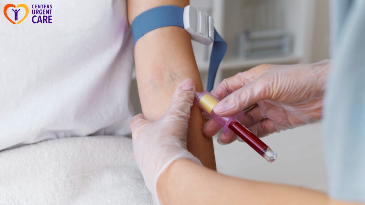 hepatitis b and c as stds