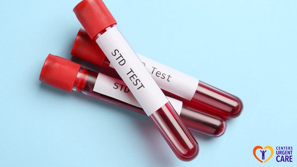 std culture test vs blood test difference