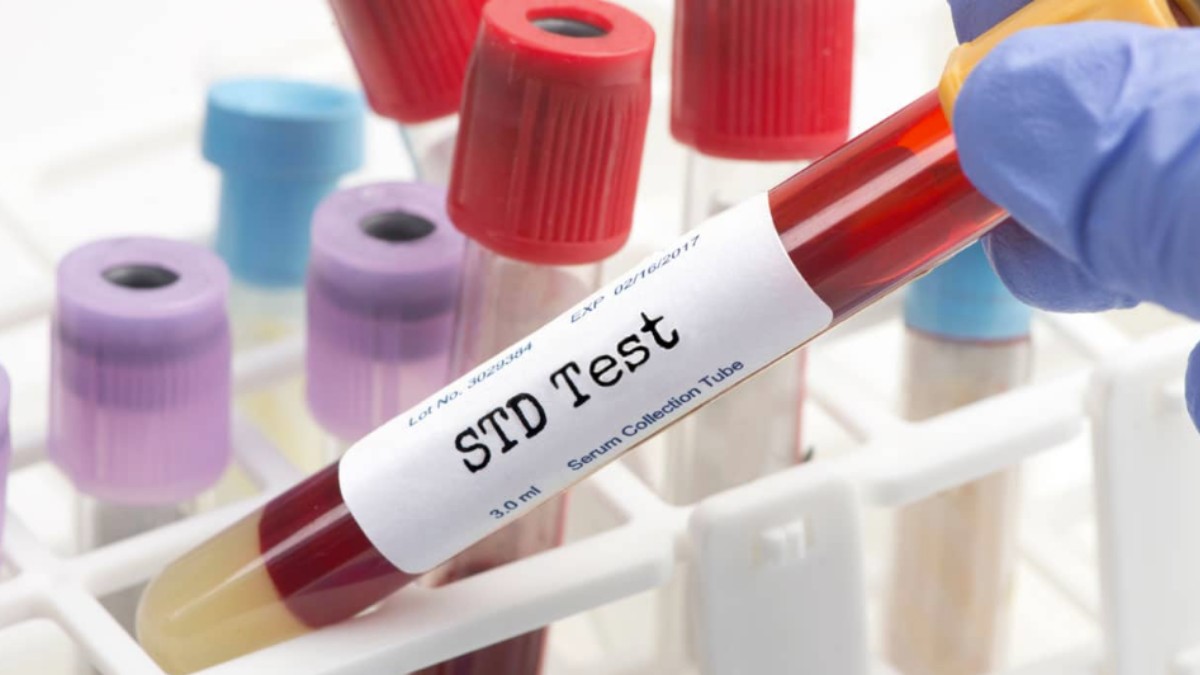 std culture test vs blood test difference