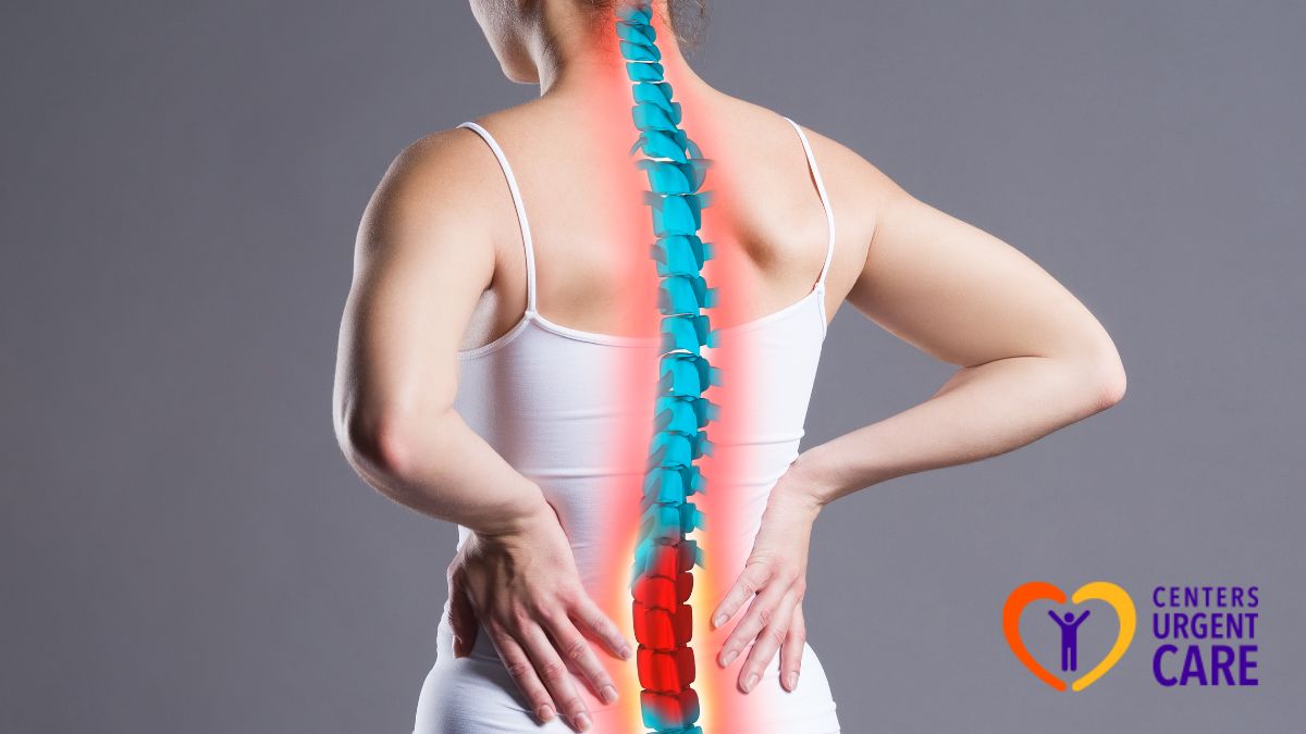 how-to-cure-sciatica