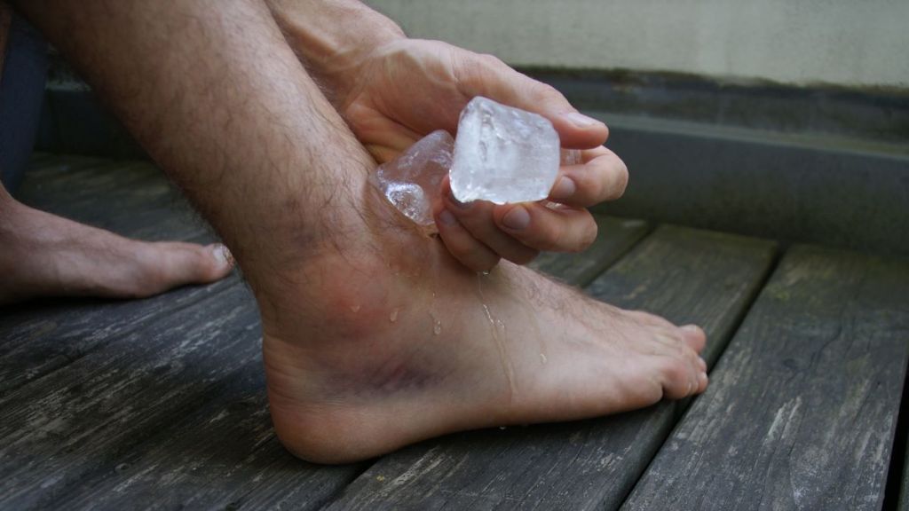 ice swollen foot