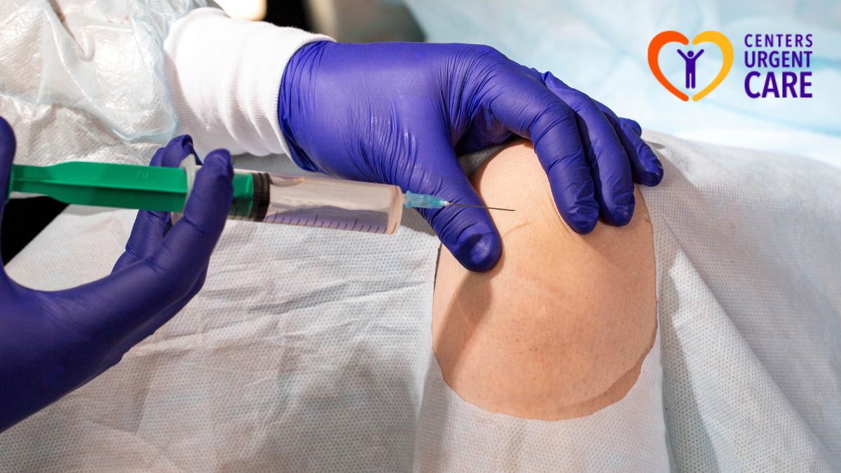 bursitis-treatment-and-prevention