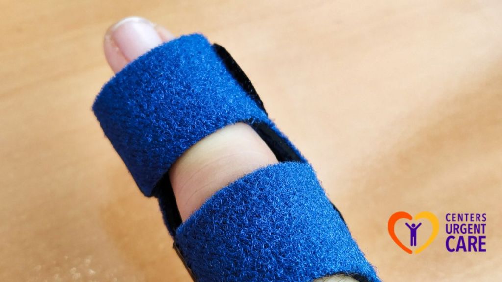 finger-dislocation-first-aid-and-treatment