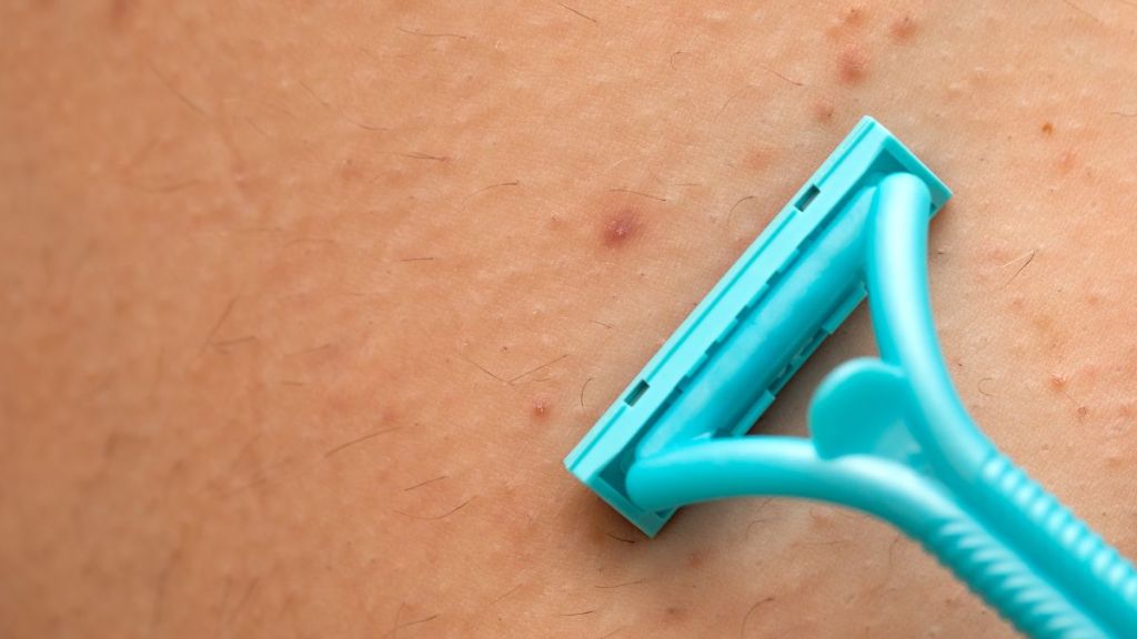 how-to-avoid-folliculitis