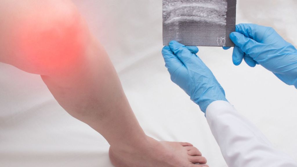 what-to-do-if-bursitis-gets-worse