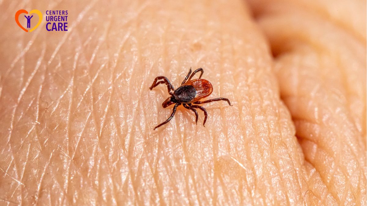 lyme-disease-testing-and-treatment