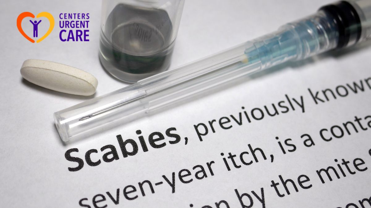 scabies-treatment